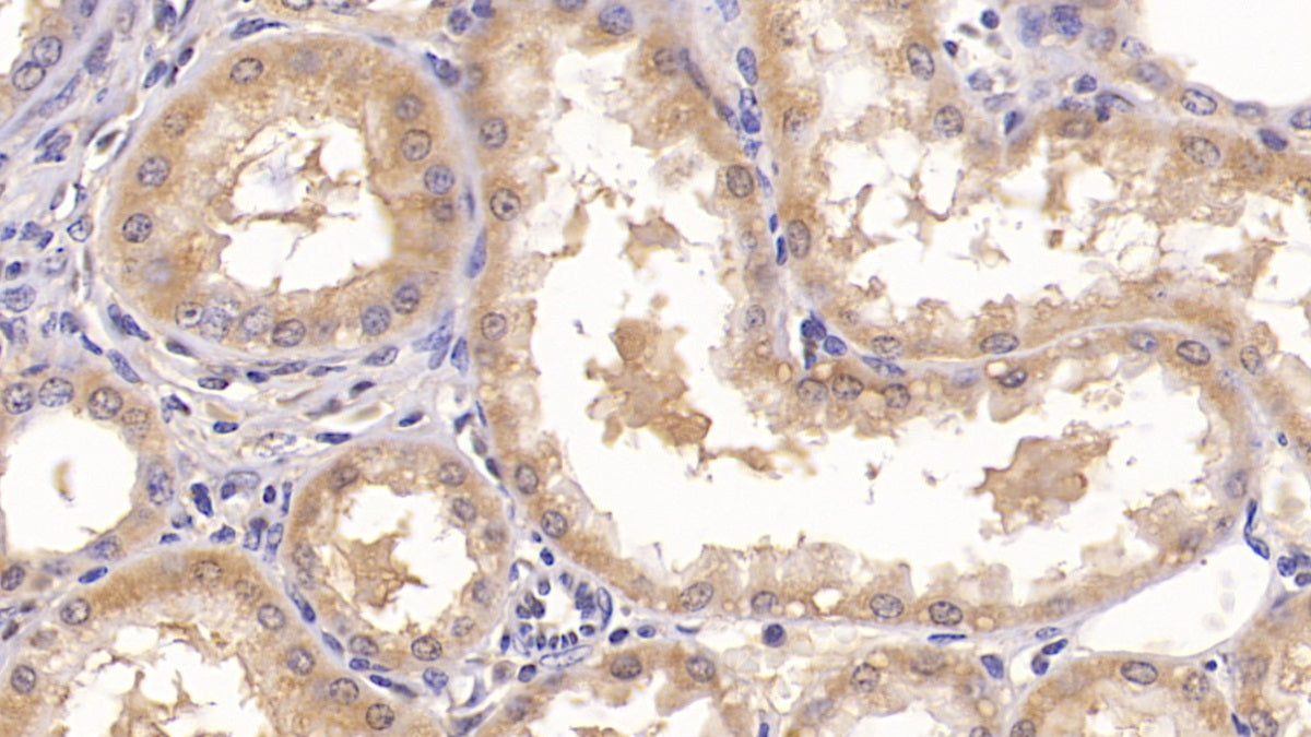 DAB staining on IHC-P; Sample: Human Small intestine Tissue; Primary Ab: 20ug/ml Mouse Anti-Human ANXA5 Antibody; Second Ab: 2ug/mL HRP-Linked Caprine Anti-Mouse IgG Polyclonal Antibody