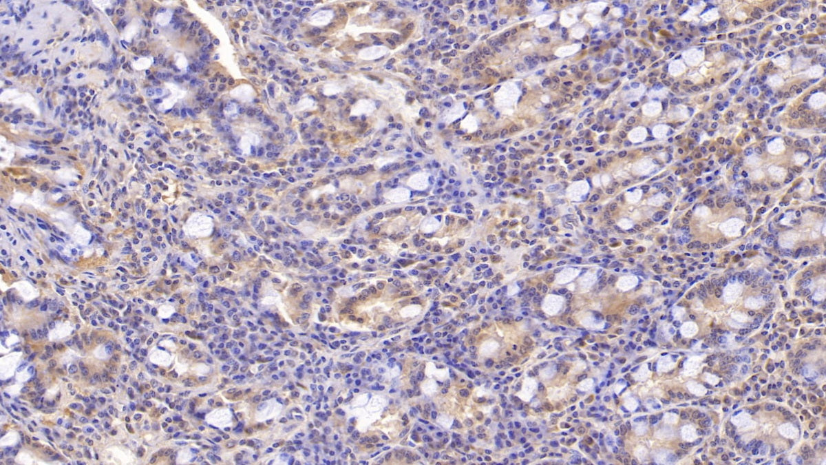 DAB staining on IHC-P; Sample: Human Cerebrum Tissue; Primary Ab: 20ug/ml Mouse Anti-Human ANXA5 Antibody; Second Ab: 2ug/mL HRP-Linked Caprine Anti-Mouse IgG Polyclonal Antibody