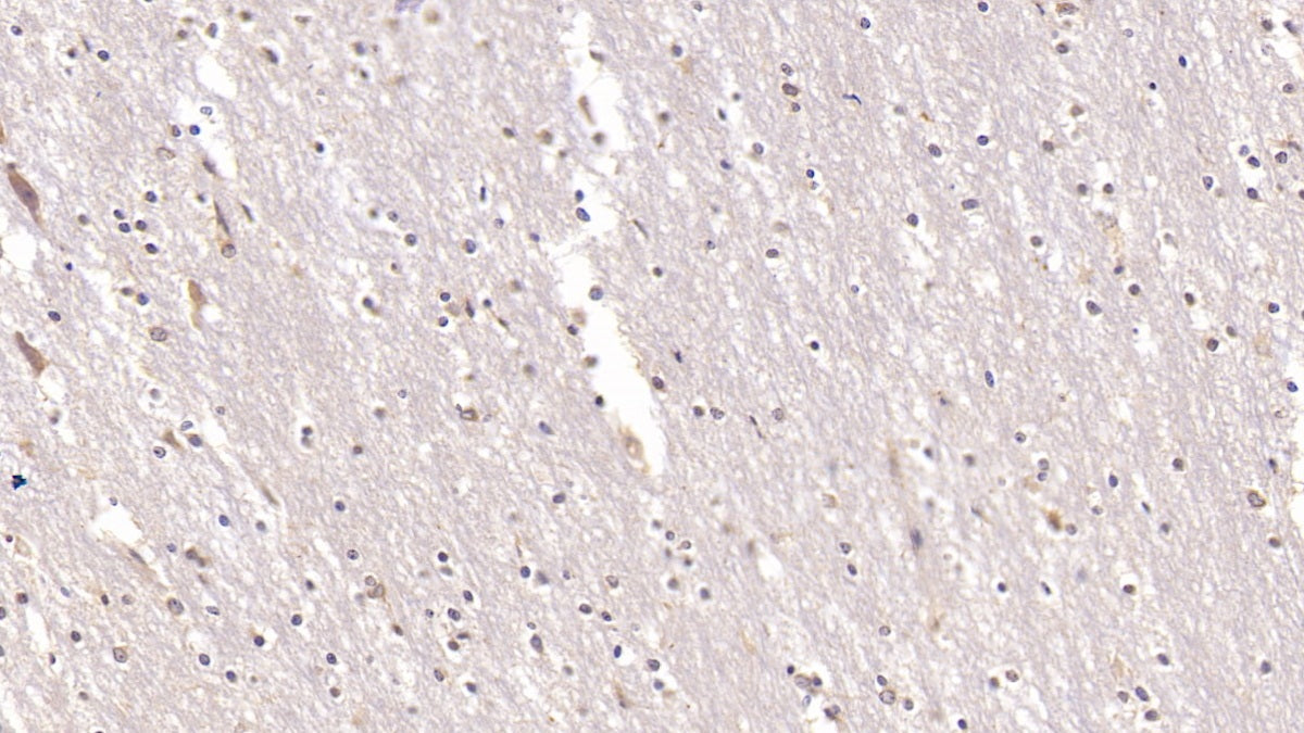 DAB staining on IHC-P; Sample: Human Spleen Tissue; Primary Ab: 20ug/ml Mouse Anti-Human ANXA5 Antibody; Second Ab: 2ug/mL HRP-Linked Caprine Anti-Mouse IgG Polyclonal Antibody