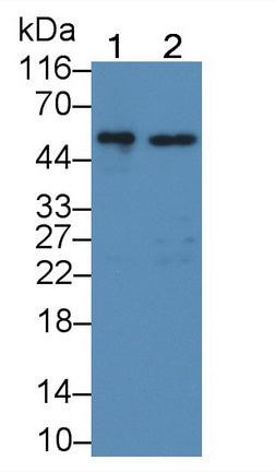 Glucocerebrosidase (GBA) Polyclonal Antibody - image 2