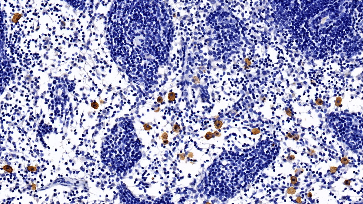 Bone Marrow Stromal Cell Antigen 1 (BST1) Monoclonal Antibody - image 2