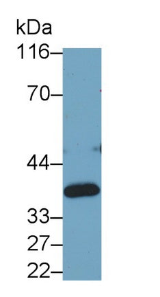 Lactate Dehydrogenase B (LDHB) Monoclonal Antibody - image 4