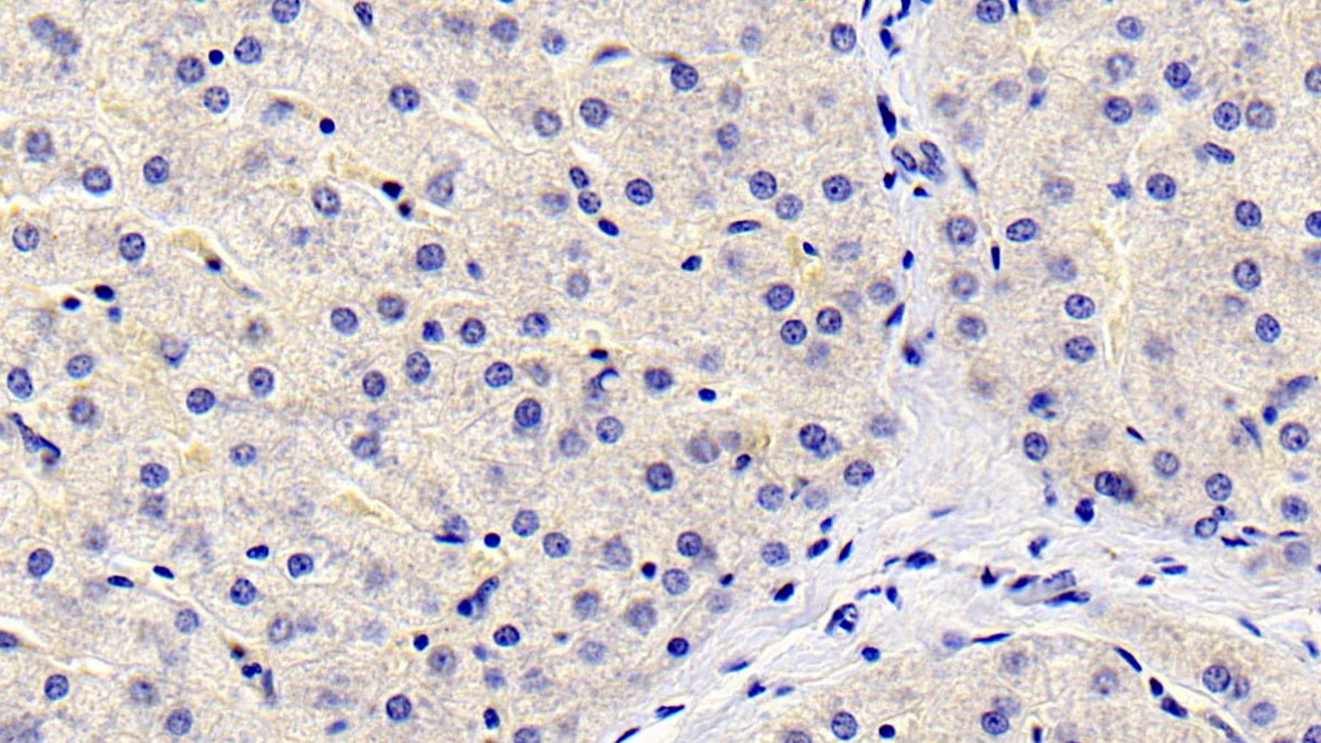 Western Blot; Sample: Human Placenta lysate Primary Ab: 2ug/ml Mouse Anti-Human FGL1 Antibody Second Ab: 0.2ug/mL HRP-Linked Caprine Anti-Mouse IgG Polyclonal Antibody
