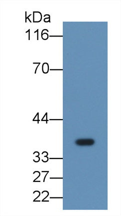 Fibrinogen Like Protein 1 (FGL1) Monoclonal Antibody - image 3