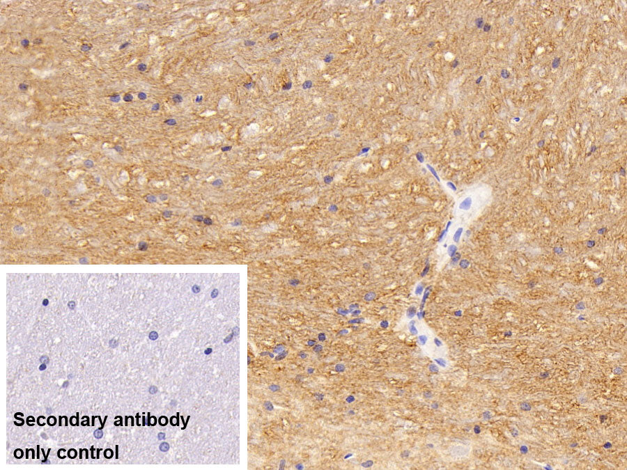 DAB staining on IHC-P; Sample: Rat Spinal cord Tissue; Primary Ab: 10ug/ml Rabbit Anti-Mouse CD56 Antibody; Control: Used PBS instead of primary antibody; Second Ab: 2ug/ml HRP-Linked Caprine Anti-Rabbit IgG Polyclonal Antibody