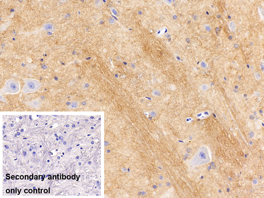 Western Blot; Samples: Lane1: Mouse Cerebrum lysate; Lane2: Mouse Cerebellum lysate; Lane3: Rat Cerebrum lysate; Primary Ab: 0.3ug/ml Rabbit Anti-Mouse CD56 Antibody; Second Ab: 0.2ug/ml HRP-Linked Caprine Anti-Rabbit IgG Polyclonal Antibody
