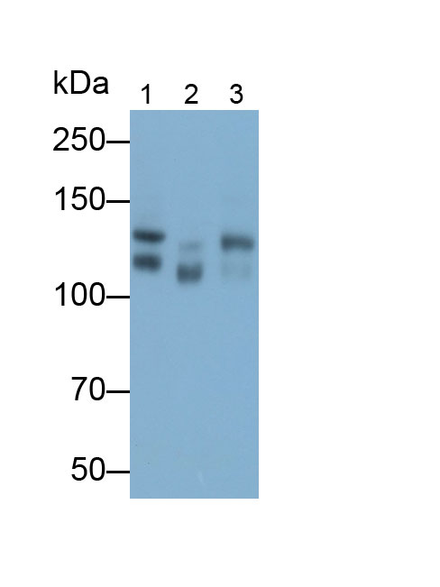 Cluster Of Differentiation 56 (CD56) Polyclonal Antibody - image 4