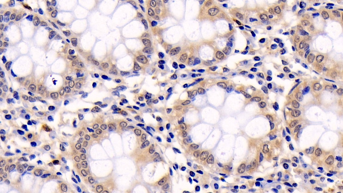 DAB staining on IHC-P; Sample: Human Kidney Tissue; Primary Ab: 20ug/ml Mouse Anti-Human ERK1 Antibody; Second Ab: 2ug/mL HRP-Linked Caprine Anti-Mouse IgG Polyclonal Antibody