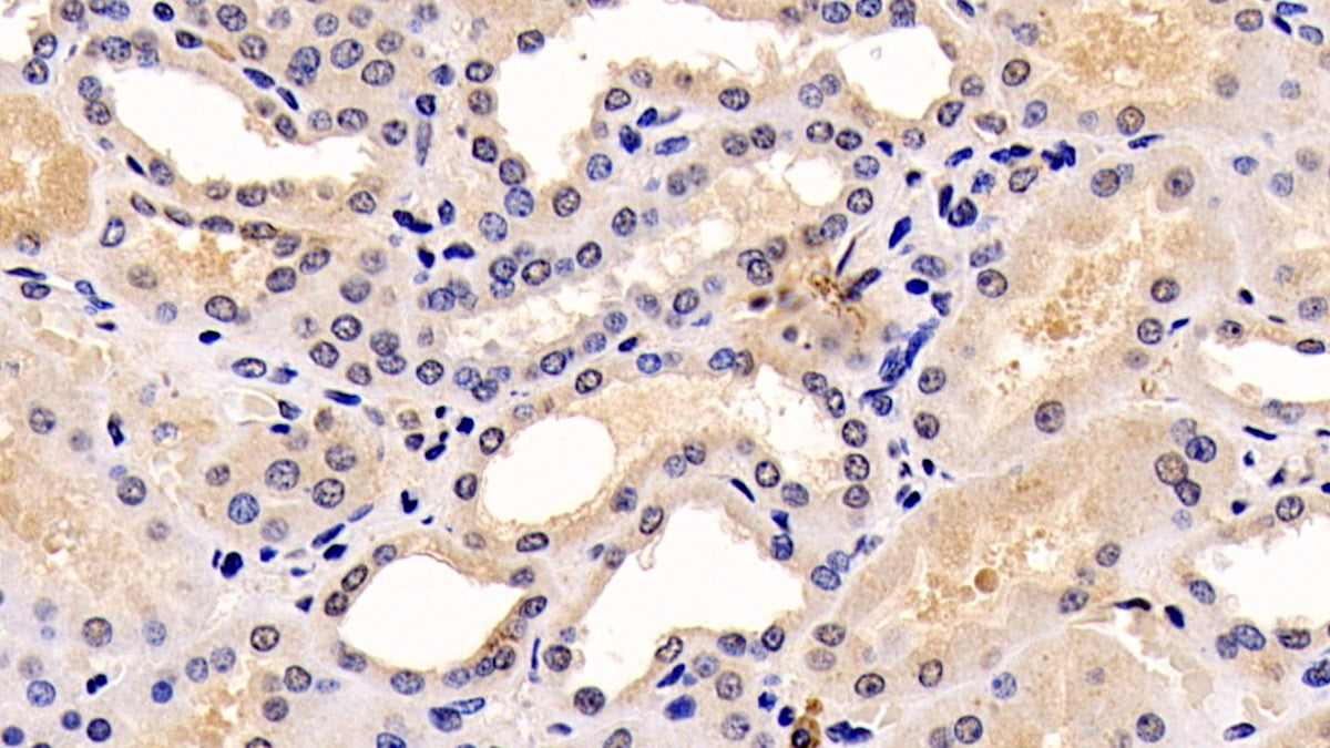 DAB staining on IHC-P; Sample: Human Liver Tissue; Primary Ab: 20ug/ml Mouse Anti-Human ERK1 Antibody; Second Ab: 2ug/mL HRP-Linked Caprine Anti-Mouse IgG Polyclonal Antibody