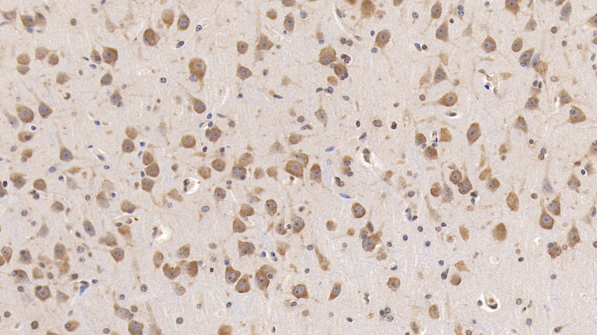 DAB staining on IHC-P; Samples: Human Kidney Tissue; Primary Ab: 30ug/ml Mouse Anti-Human RAB5A Antibody; Second Ab: 2ug/mL HRP-Linked Caprine Anti-Mouse IgG Polyclonal Antibody