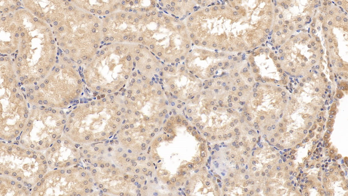 Western Blot; Sample: Lane1: Porcine Cerebrum lysate; Lane2: Rat Cerebrum lysate; Lane3: Hela cell lysate Primary Ab: 2ug/ml Mouse Anti-Human RAB5A Antibody Second Ab: 0.2ug/mL HRP-Linked Rabbit Anti-Mouse IgG Polyclonal Antibody