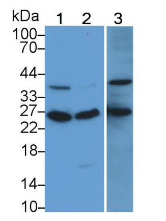 RAB5A, Member RAS Oncogene Family (RAB5A) Monoclonal Antibody - image 5