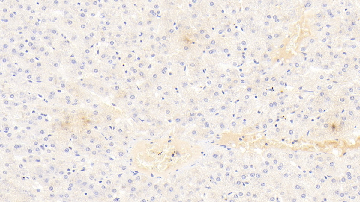 Western Blot; Sample: Lane1: Porcine Liver lysate; Lane2: Porcine Heart lysate; Lane3: Hela cell lysate Primary Ab: 2ug/ml Mouse Anti-Human ALPL Antibody Second Ab: 0.2ug/mL HRP-Linked Caprine Anti-Mouse IgG Polyclonal Antibody