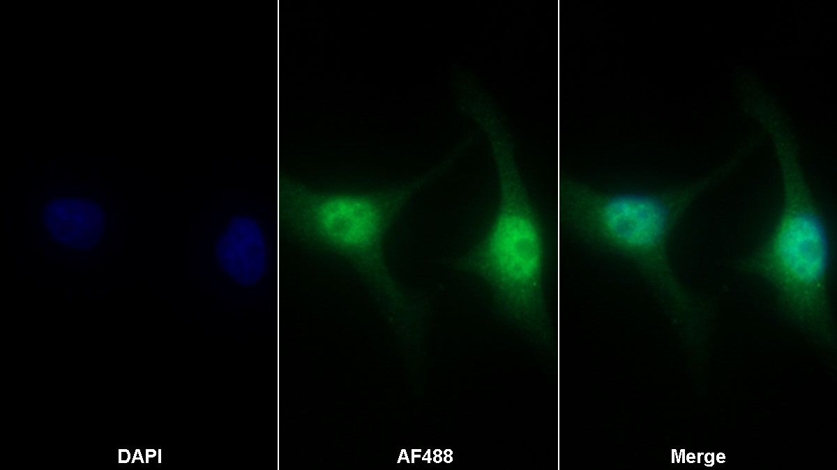 Western Blot; Sample: Hela cell lysate Primary Ab: 0.2ug/ml Rabbit Anti-Human ANLN Antibody Second Ab: 0.2ug/mL HRP-Linked Caprine Anti-Rabbit IgG Polyclonal Antibody
