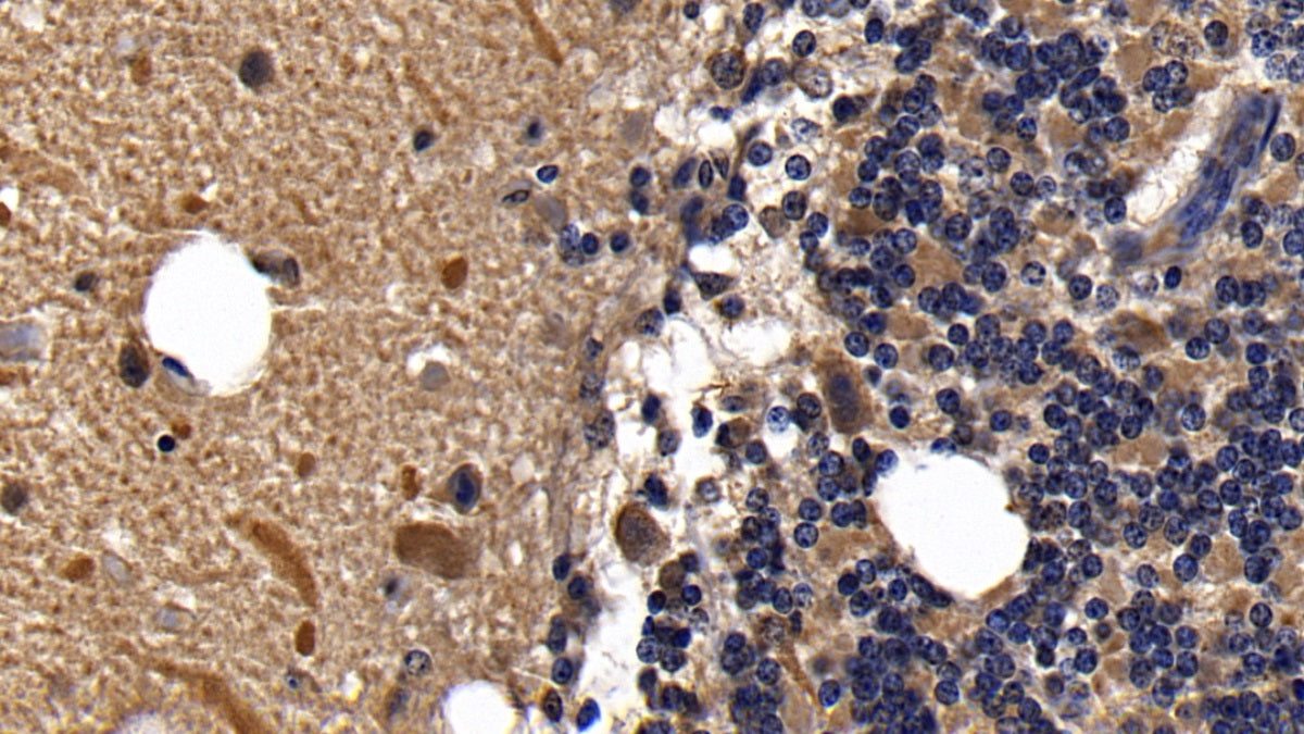 DAB staining on IHC-P; Sample: Human Cerebrum Tissue; Primary Ab: 10ug/ml Rabbit Anti-Human Ab1-40 Antibody; Second Ab: 2ug/mL HRP-Linked Caprine Anti-Rabbit IgG Polyclonal Antibody