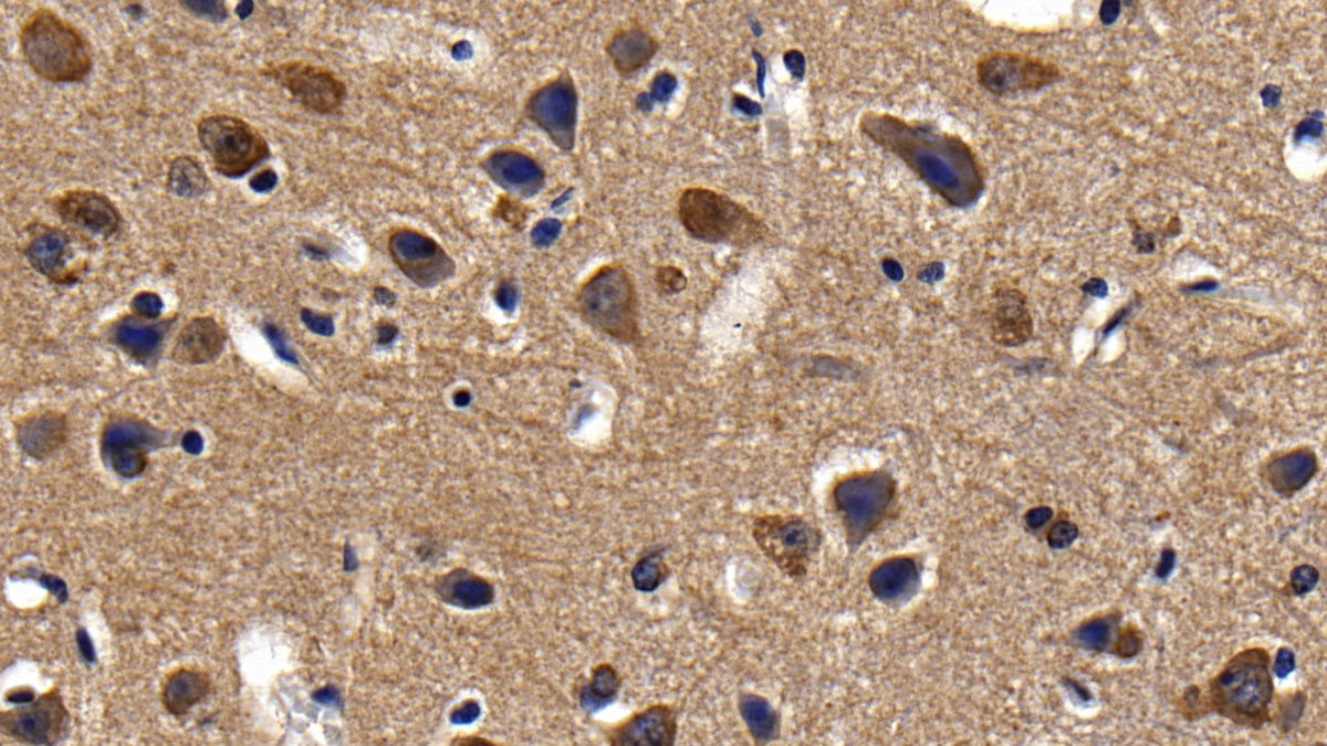 Western Blot; Sample: Lane1: Rat Cerebrum lysate; Lane2: Mouse Cerebrum lysate; Lane3: Porcine Cerebrum lysate Primary Ab: 0.04ug/ml Rabbit Anti-Human Ab1-40 Antibody Second Ab: 0.2ug/mL HRP-Linked Caprine Anti-Rabbit IgG Polyclonal Antibody