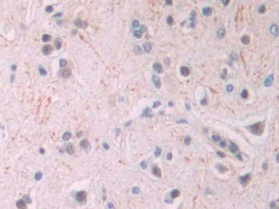 Amyloid Beta Peptide 1-42 (Ab1-42) Monoclonal Antibody - image 2