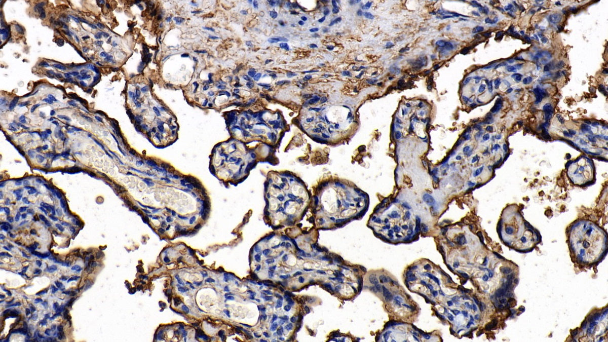 DAB staining on IHC-P; Sample: Human Lung Tissue; Primary Ab: 10ug/ml Rabbit Anti-Human ANXA2 Antibody; Second Ab: 2ug/mL HRP-Linked Caprine Anti-Rabbit IgG Polyclonal Antibody