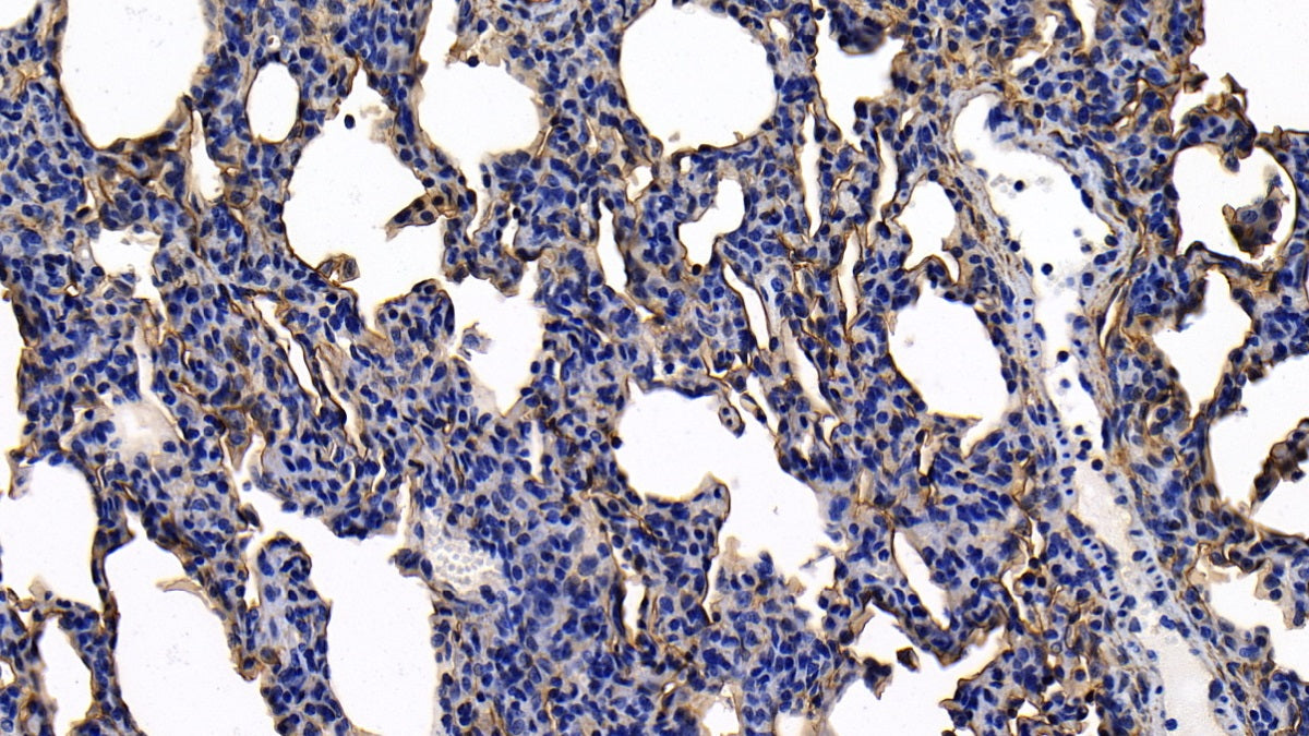DAB staining on IHC-P; Sample: Human Kidney Tissue; Primary Ab: 10ug/ml Rabbit Anti-Human ANXA2 Antibody; Second Ab: 2ug/mL HRP-Linked Caprine Anti-Rabbit IgG Polyclonal Antibody