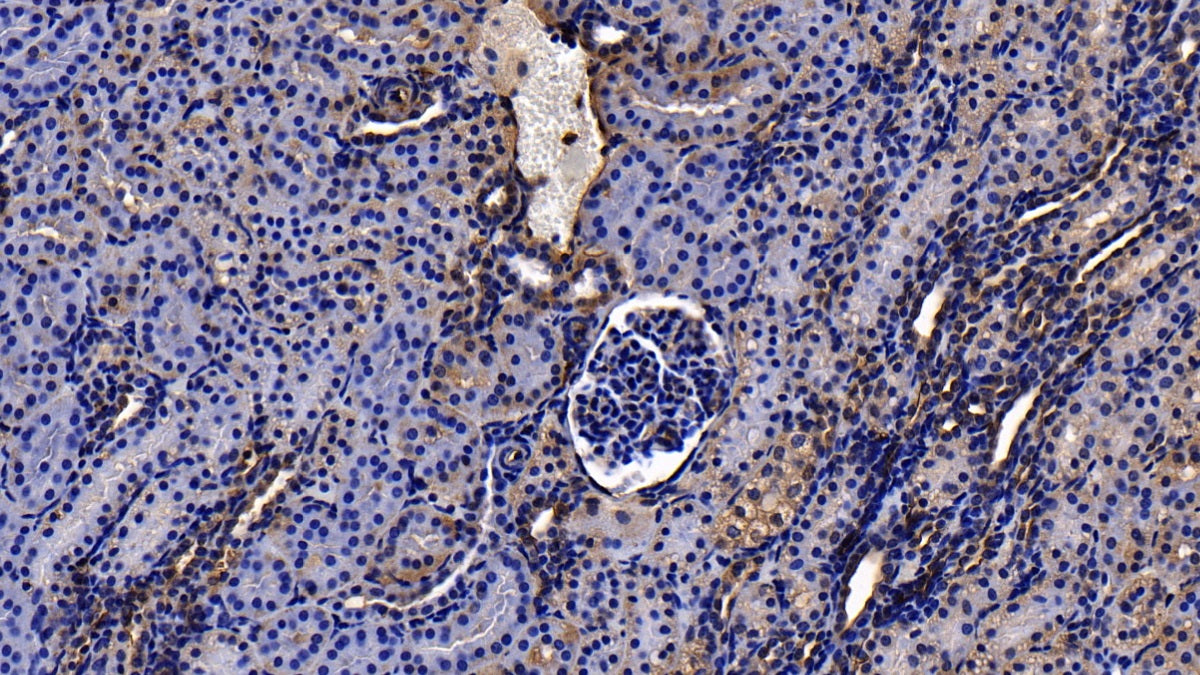 DAB staining on IHC-P; Sample: Human Liver Tissue; Primary Ab: 10ug/ml Rabbit Anti-Human ANXA2 Antibody; Second Ab: 2ug/mL HRP-Linked Caprine Anti-Rabbit IgG Polyclonal Antibody