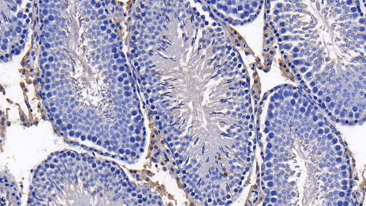 DAB staining on IHC-P; Sample: Rat Kidney Tissue; Primary Ab: 20ug/ml Mouse Anti-Human a1AT Antibody; Second Ab: 2ug/mL HRP-Linked Caprine Anti-Mouse IgG Polyclonal Antibody