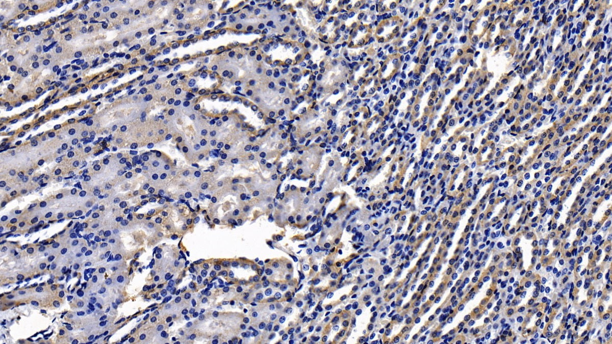 DAB staining on IHC-P; Sample: Rat Liver Tissue; Primary Ab: 20ug/ml Mouse Anti-Human a1AT Antibody; Second Ab: 2ug/mL HRP-Linked Caprine Anti-Mouse IgG Polyclonal Antibody