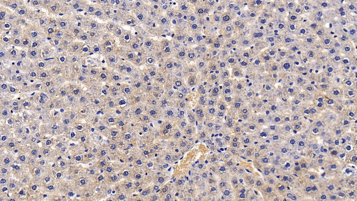 Western Blot; Sample: Lane1: Human Serum; Lane2: Human Plasma; Lane3: Human Lung lysate Primary Ab: 0.2ug/ml Mouse Anti-Human a1AT Antibody Second Ab: 0.2ug/mL HRP-Linked Caprine Anti-Mouse IgG Polyclonal Antibody