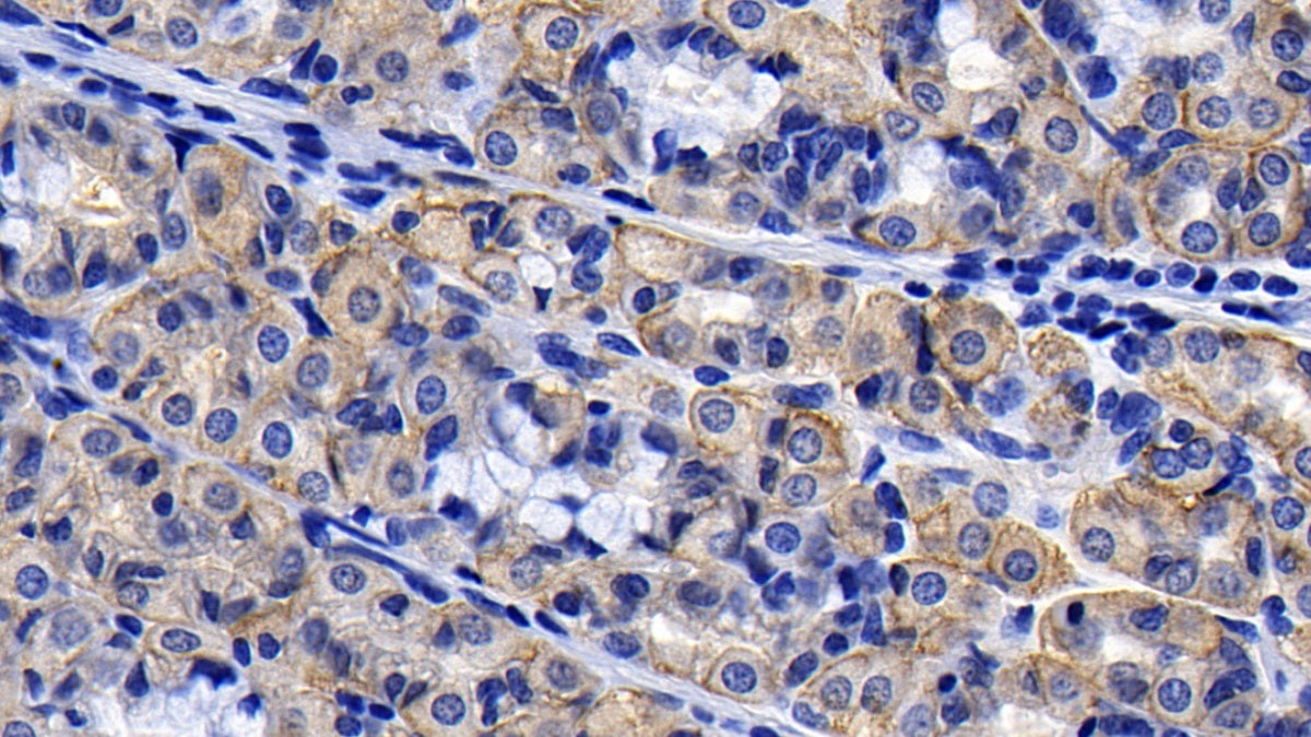 DAB staining on IHC-P; Sample: Human Small intestine Tissue; Primary Ab: 10ug/ml Mouse Anti-Human ACE2 Antibody; Second Ab: 2ug/mL HRP-Linked Caprine Anti-Mouse IgG Polyclonal Antibody