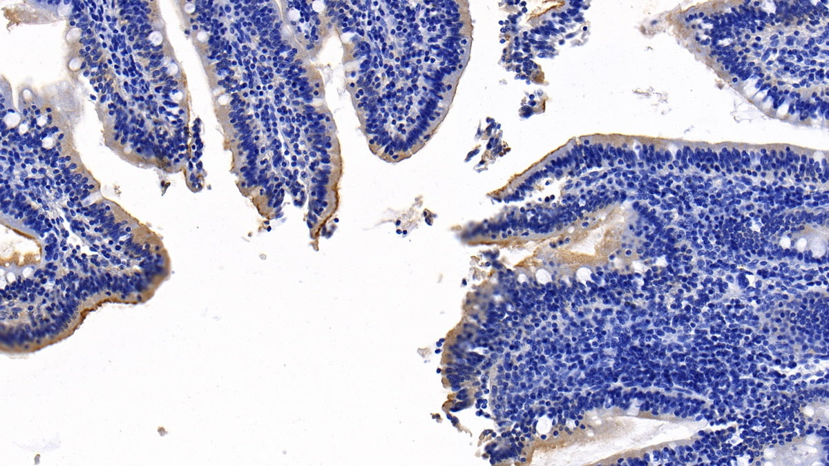 DAB staining on IHC-P; Sample: Human Colon Tissue; Primary Ab: 10ug/ml Mouse Anti-Human ACE2 Antibody; Second Ab: 2ug/mL HRP-Linked Caprine Anti-Mouse IgG Polyclonal Antibody
