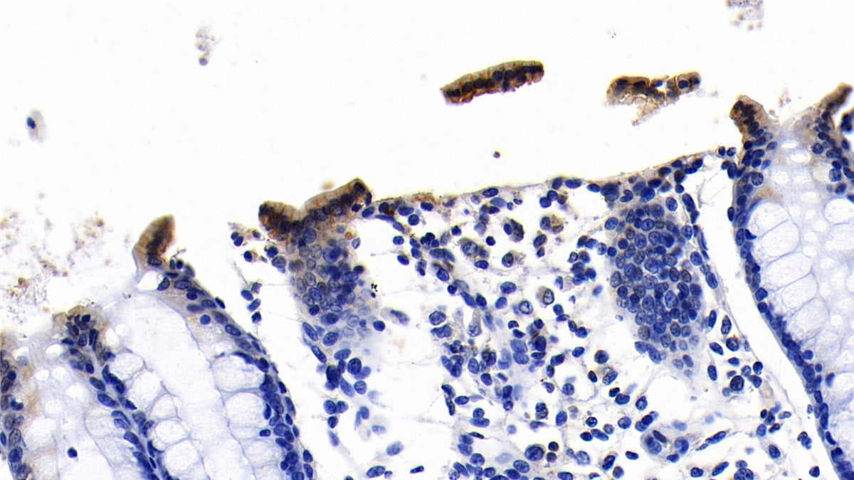 Angiotensin I Converting Enzyme 2 (ACE2) Monoclonal Antibody - image 5