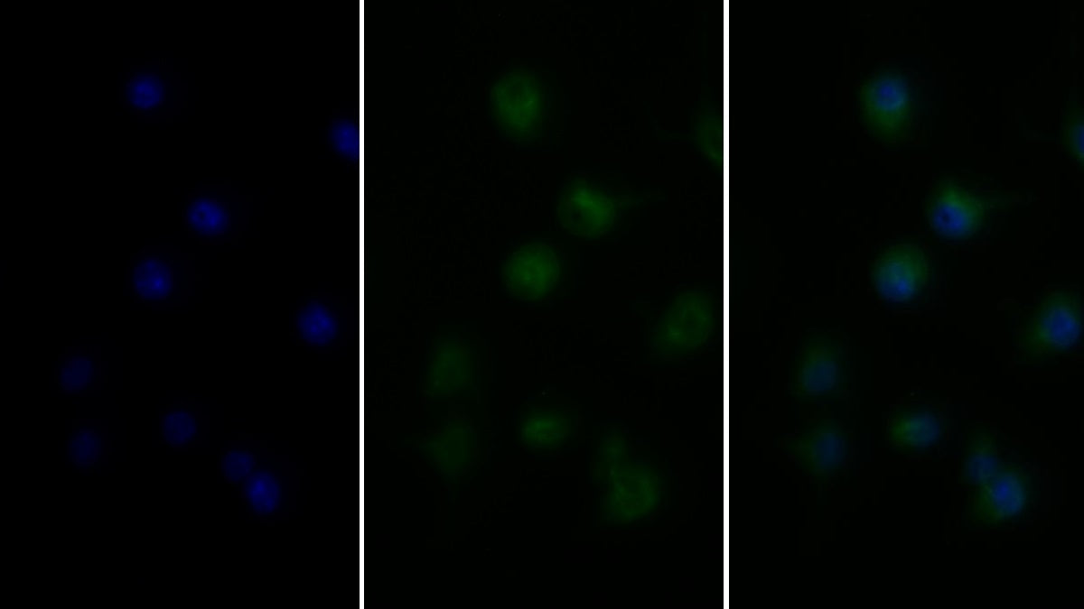 Tumor Necrosis Factor Alpha (TNFa) Monoclonal Antibody - image 2