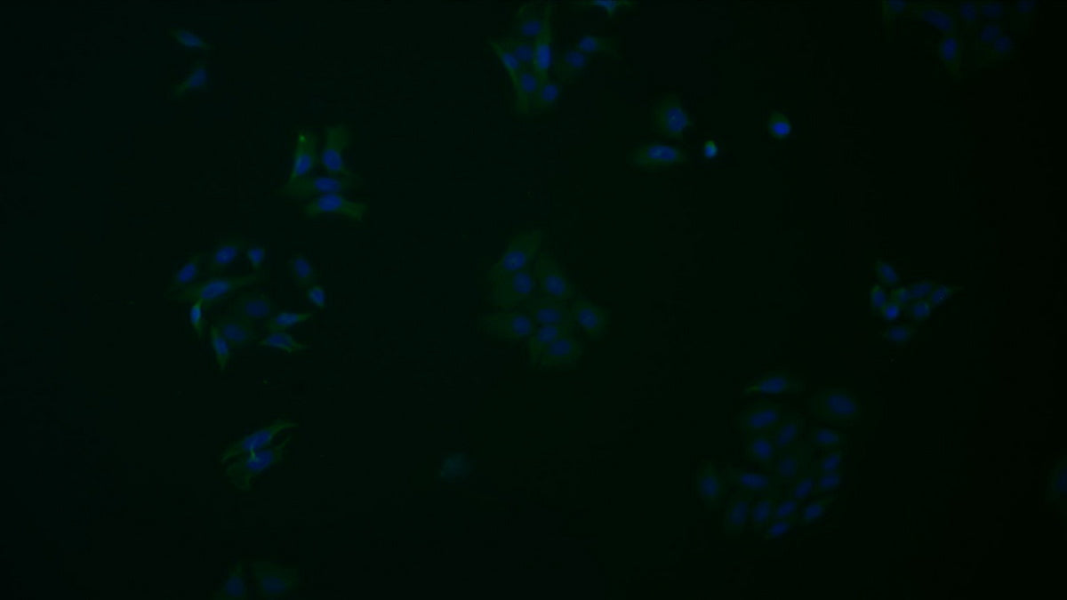 Western Blot; Sample: Lane1: Jurkat cell lysate; Lane2: K562 cell lysate; Lane3: HepG2 cell lysate Primary Ab: 4ug/ml Mouse Anti-Human LAG3 Antibody Second Ab: 0.2ug/mL HRP-Linked Caprine Anti-Mouse IgG Polyclonal Antibody
