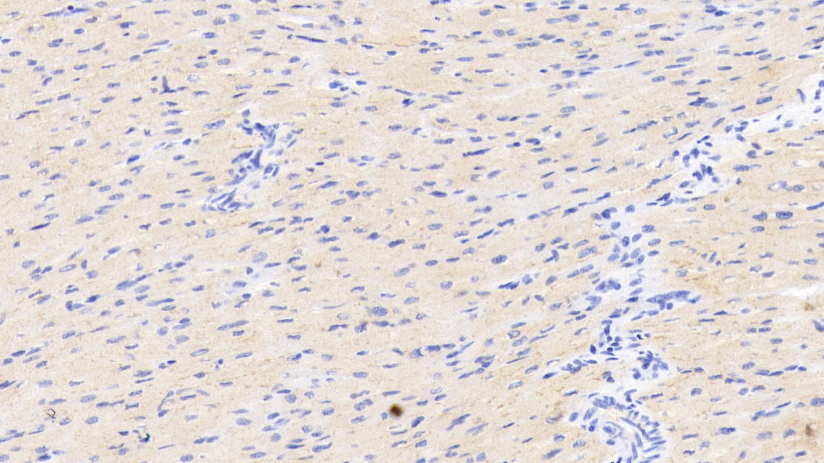 DAB staining on IHC-P; Sample: Human Cardiac Muscle Tissue; Primary Ab: 20ug/ml Mouse Anti-Human ADPN Antibody; Control: Used PBS instead of primary antibody; Second Ab: 2ug/ml HRP-Linked Caprine Anti-Mouse IgG Polyclonal Antibody