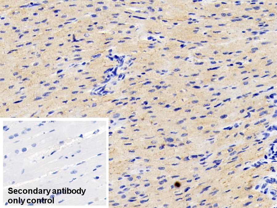 DAB staining on IHC-P; Sample: Rat Cardiac Muscle Tissue; Primary Ab: 30ug/ml Mouse Anti-Human ADPN Antibody; Control: Used PBS instead of primary antibody; Second Ab: 2ug/ml HRP-Linked Caprine Anti-Mouse IgG Polyclonal Antibody