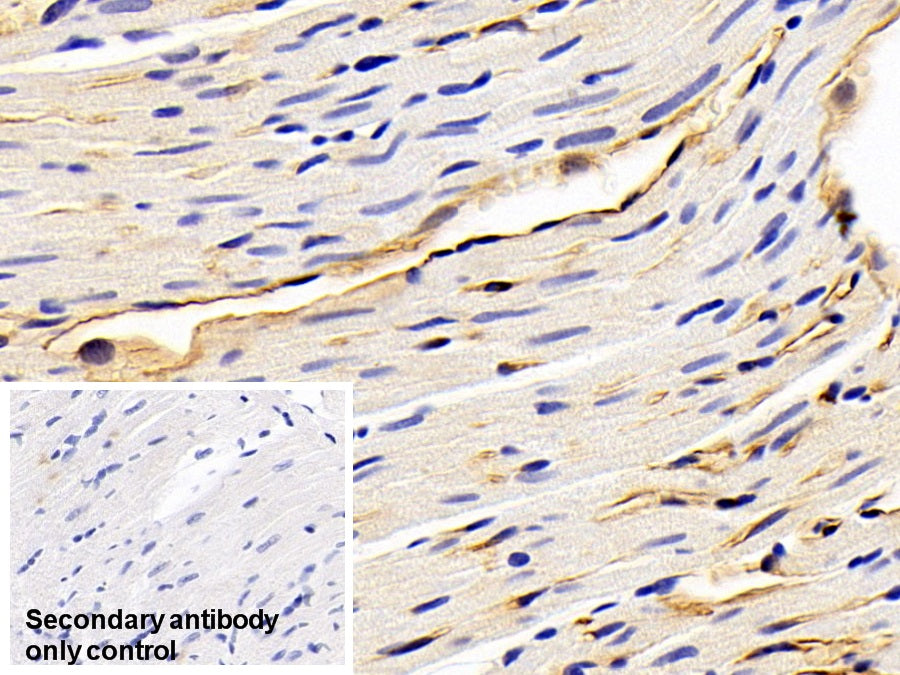 DAB staining on IHC-P; Sample: Rat Ovary Tissue; Primary Ab: 30ug/ml Mouse Anti-Human ADPN Antibody; Control: Used PBS instead of primary antibody; Second Ab: 2ug/ml HRP-Linked Caprine Anti-Mouse IgG Polyclonal Antibody