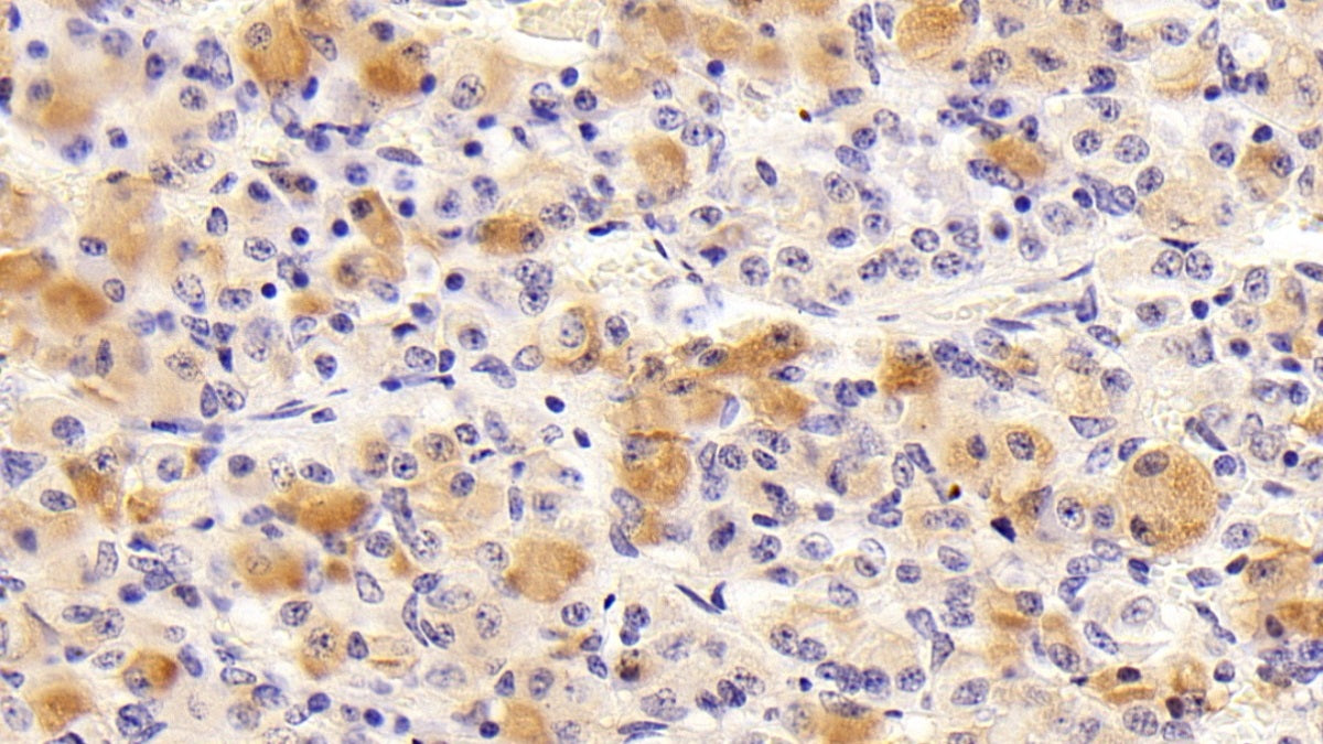 DAB staining on IHC-P; Sample: Porcine Pituitary Tissue; Primary Ab: 10ug/ml Rabbit Anti-Mouse FSHb Antibody; Control: Used PBS instead of primary antibody; Second Ab: 2ug/ml HRP-Linked Caprine Anti-Rabbit IgG Polyclonal Antibody