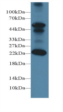 Follicle Stimulating Hormone Beta (FSHb) Polyclonal Antibody - image 4