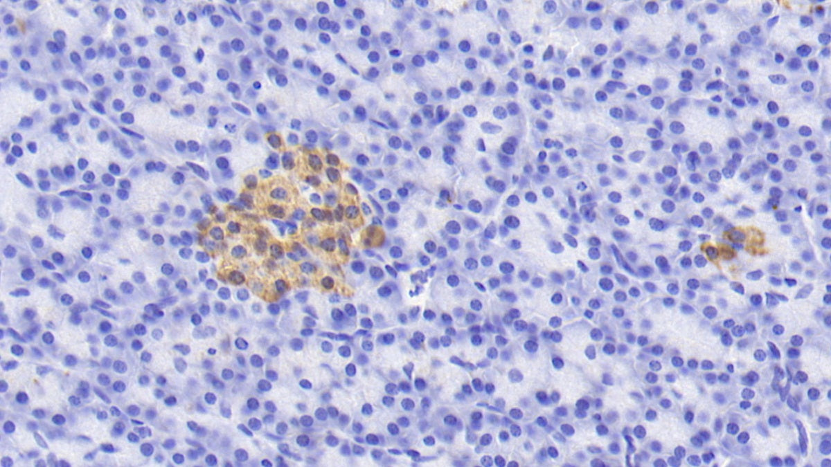 DAB staining on IHC-P; Sample: Human Cardiac Muscle Tissue; Primary Ab: 20ug/ml Mouse Anti-Human CASP9 Antibody; Second Ab: 2ug/mL HRP-Linked Caprine Anti-Mouse IgG Polyclonal Antibody