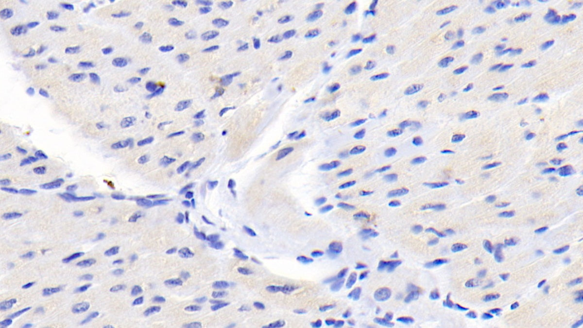 FITC staining on IF; Sample: Human HepG2 cell; Primary Ab: 40ug/ml Mouse Anti-Human CASP9 Antibody; Second Ab: 5ug/ml FITC-Linked Caprine Anti-Mouse IgG Polyclonal Antibody