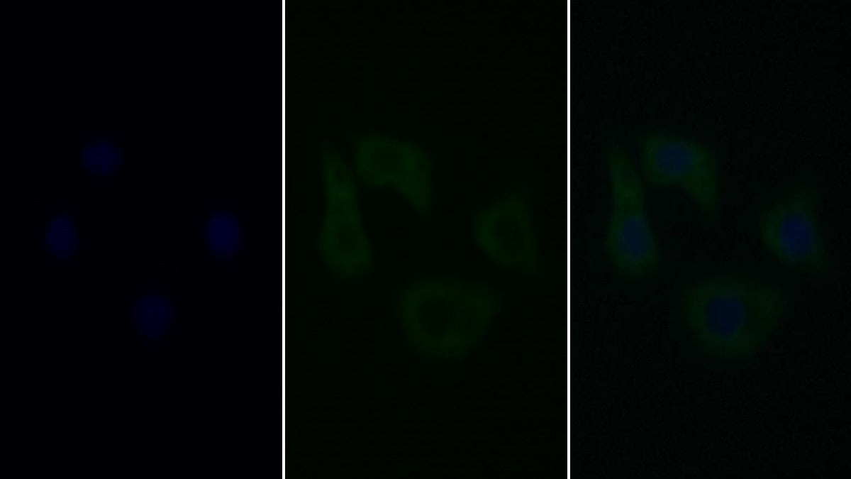 FITC staining on IF; Sample: Human Hela cell; Primary Ab: 40ug/ml Mouse Anti-Human CASP9 Antibody; Second Ab: 5ug/ml FITC-Linked Caprine Anti-Mouse IgG Polyclonal Antibody
