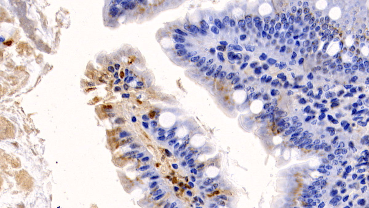 Western Blot; Sample: Lane1: Rabbit Testis lysate; Lane2: Rabbit Thymus lysate; Lane3: Rabbit Small intestine lysate; Lane4: Jurkat cell lysate Primary Ab: 1ug/ml Mouse Anti-Rat IL17 Antibody Second Ab: 0.2ug/mL HRP-Linked Caprine Anti-Mouse IgG Polyclonal Antibody