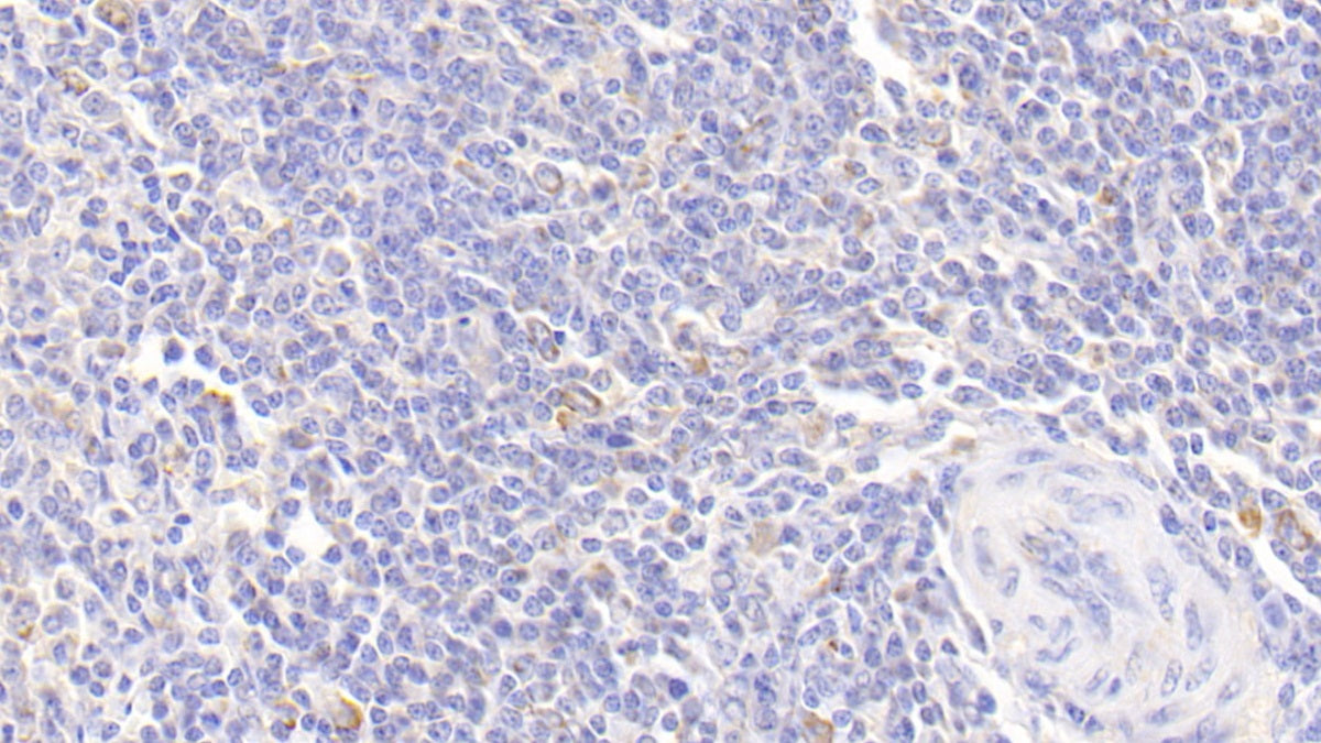 DAB staining on IHC-P; Sample: Human Kidney Tissue; Primary Ab: 20ug/ml Mouse Anti-Human a1AT Antibody; Second Ab: 2ug/mL HRP-Linked Caprine Anti-Mouse IgG Polyclonal Antibody