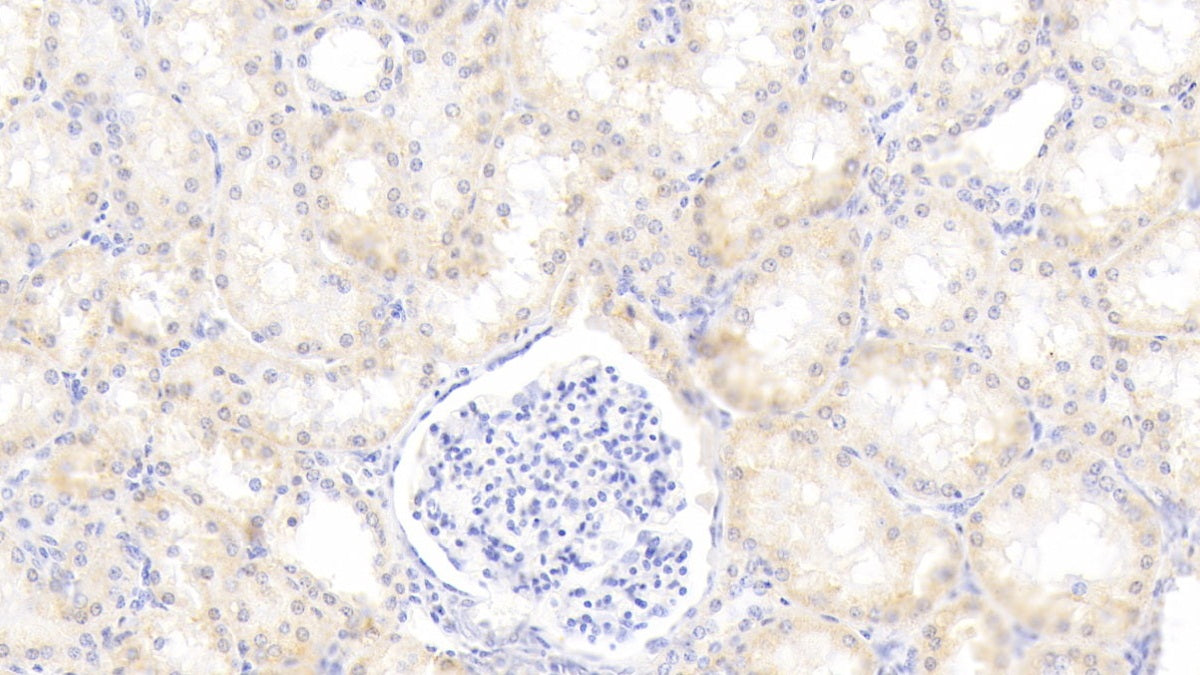 DAB staining on IHC-P; Sample: Human Liver Tissue; Primary Ab: 20ug/ml Mouse Anti-Human a1AT Antibody; Second Ab: 2ug/mL HRP-Linked Caprine Anti-Mouse IgG Polyclonal Antibody