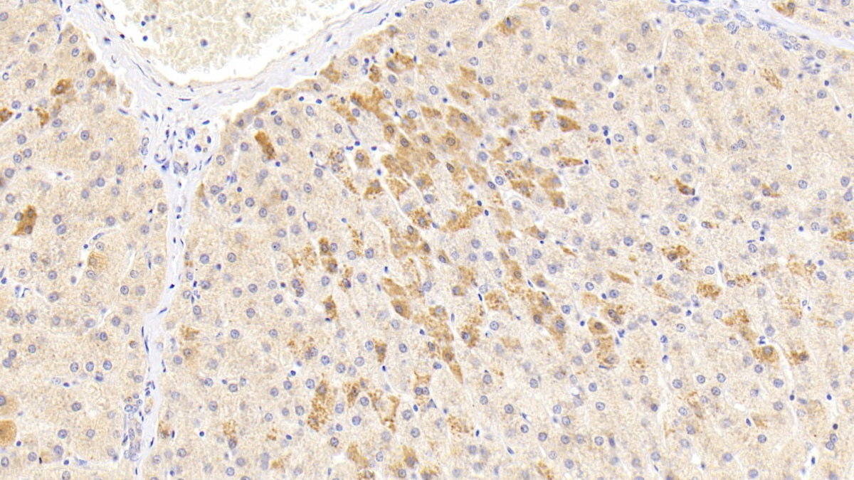 DAB staining on IHC-P; Sample: Human Liver Tissue; Primary Ab: 20ug/ml Mouse Anti-Human a1AT Antibody; Control: Used PBS instead of primary antibody; Second Ab: 2ug/ml HRP-Linked Caprine Anti-Mouse IgG Polyclonal Antibody