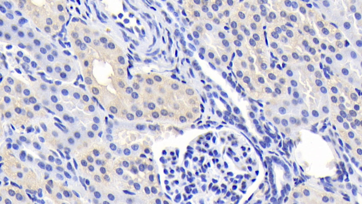 Phenylalanine Hydroxylase (PAH) Monoclonal Antibody - image 2