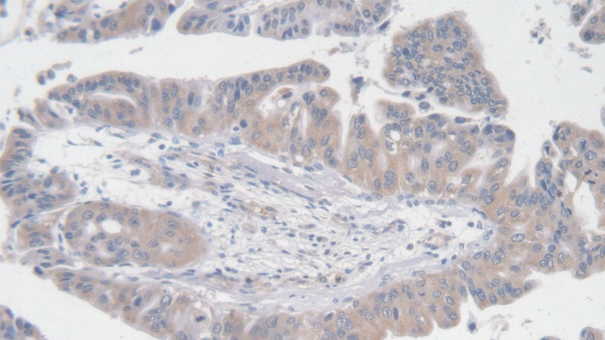DAB staining on IHC-P; Samples: Human Kidney Tissue; Primary Ab: 20ug/ml Rabbit Anti-Multi-species AngI Antibody; Second Ab: 2ug/mL HRP-Linked Caprine Anti-Rabbit IgG Polyclonal Antibody