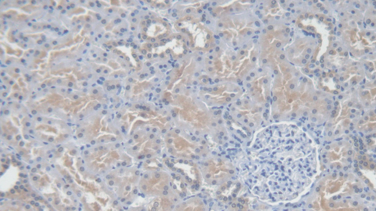Angiotensin I (AngI) Polyclonal Antibody - image 4