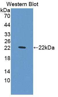 Acyl Coenzyme A Oxidase 3, Pristanoyl (ACOX3) Polyclonal Antibody - image 3