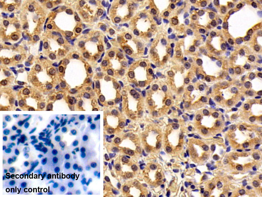 DAB staining on IHC-P; Sample: Rat Spinal cord Tissue; Primary Ab: 30ug/ml Mouse Anti-Human OCT4 Antibody; Control: Used PBS instead of primary antibody; Second Ab: 2ug/ml HRP-Linked Caprine Anti-Mouse IgG Polyclonal Antibody