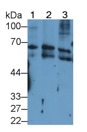 Keratin 2 (CK2) Monoclonal Antibody - image 2